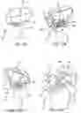 Fig. 16 - METHOD OF IMPLANTING VALVE PROSTHESIS HAVING ATRIAL ANCHORING