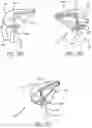 Fig. 17 - METHOD OF IMPLANTING VALVE PROSTHESIS HAVING ATRIAL ANCHORING