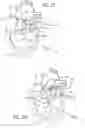 Fig. 23 - METHOD OF IMPLANTING VALVE PROSTHESIS HAVING ATRIAL ANCHORING