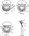 Fig. 07 - Device and Method for Temporary or Permanent Suspension of an Implantable Scaffolding Containing an Orifice for Placement of a Prosthetic or Bio-Prosthetic Valve