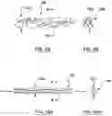 Fig. 06 - Transcatheter prosthesis with sealing component, and systems and methods for delivering and deployment thereof