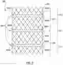 Fig. 09 - Transcatheter prosthesis with sealing component, and systems and methods for delivering and deployment thereof