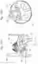 Fig. 10 - Prosthetic heart valve packaging and deployment systems