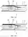 Fig. 10 - Easy-to-control interventional instrument delivery device