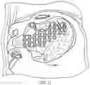 Fig. 09 - SYSTEM AND METHOD FOR FORMING MATERIAL LAYERS FOR SURGICAL APPLICATIONS