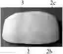 Fig. 01 - Device implantable in a human body and production method thereof