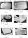 Fig. 02 - Device implantable in a human body and production method thereof