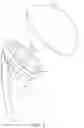 Fig. 04 - Shoulder arthroplasty implant system