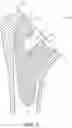 Fig. 06 - Shoulder arthroplasty implant system