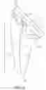 Fig. 07 - Shoulder arthroplasty implant system