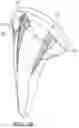Fig. 28 - Shoulder arthroplasty implant system