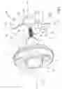Fig. 02 - Augment insert, shoulder prosthesis and kit comprising the augment insert