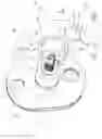Fig. 03 - Augment insert, shoulder prosthesis and kit comprising the augment insert