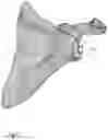 Fig. 06 - Augment insert, shoulder prosthesis and kit comprising the augment insert