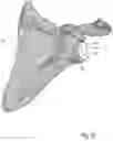 Fig. 11 - Augment insert, shoulder prosthesis and kit comprising the augment insert