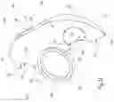 Fig. 12 - Augment insert, shoulder prosthesis and kit comprising the augment insert