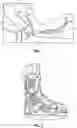 Fig. 02 - Removeable Cast Walker With Ankle Lock and Use-Detection and Reporting Means