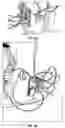 Fig. 07 - Removeable Cast Walker With Ankle Lock and Use-Detection and Reporting Means