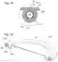 Fig. 07 - METHOD FOR AUTOMATICALLY REMOVING URINE FROM A FEMALE PATIENT