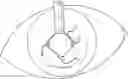 Fig. 01 - Ring used in a small pupil phacoemulsification procedure