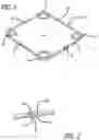 Fig. 02 - Ring used in a small pupil phacoemulsification procedure