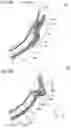 Fig. 07 - ABSORBENT ARTICLE