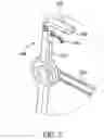 Fig. 11 - Progressive mobility aid device