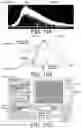 Fig. 10 - Compression device especially for preventing deep vein thrombosis