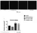 Fig. 22 - Liposomal compounds and methods of use thereof