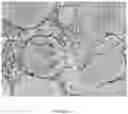 Fig. 18 - Encapsulation Methods and Compositions