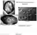 Fig. 19 - Encapsulation Methods and Compositions