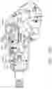 Fig. 102 - Tissue thickness compensator configured to redistribute compressive forces