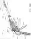 Fig. 94 - Tissue thickness compensator configured to redistribute compressive forces