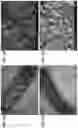 Fig. 04 - PREVENTION OF URINARY TRACT DEVICE ENCRUSTATION