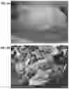 Fig. 05 - PREVENTION OF URINARY TRACT DEVICE ENCRUSTATION