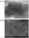 Fig. 06 - PREVENTION OF URINARY TRACT DEVICE ENCRUSTATION