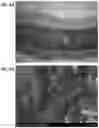 Fig. 07 - PREVENTION OF URINARY TRACT DEVICE ENCRUSTATION