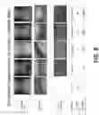 Fig. 09 - PREVENTION OF URINARY TRACT DEVICE ENCRUSTATION