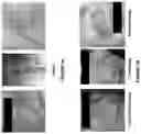 Fig. 02 - COMPOSITIONS AND METHODS FOR TREATING NEOPLASIA