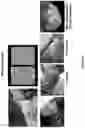 Fig. 28 - COMPOSITIONS AND METHODS FOR TREATING NEOPLASIA