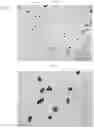 Fig. 02 - FEXOFENADINE MICROCAPSULES AND COMPOSITIONS CONTAINING THEM