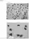 Fig. 04 - FEXOFENADINE MICROCAPSULES AND COMPOSITIONS CONTAINING THEM