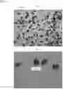 Fig. 05 - FEXOFENADINE MICROCAPSULES AND COMPOSITIONS CONTAINING THEM
