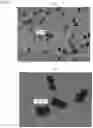 Fig. 06 - FEXOFENADINE MICROCAPSULES AND COMPOSITIONS CONTAINING THEM