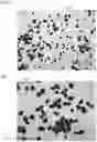 Fig. 07 - FEXOFENADINE MICROCAPSULES AND COMPOSITIONS CONTAINING THEM