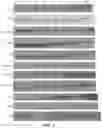 Fig. 02 - Killing senescent cells and treating senescence-associated conditions using a SRC inhibitor and a flavonoid