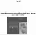 Fig. 03 - METHODS AND COMPOSITIONS FOR MITOCHONDRIAL REPLACEMENT THERAPY