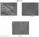 Fig. 08 - METHODS AND COMPOSITIONS FOR MITOCHONDRIAL REPLACEMENT THERAPY