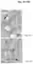 Fig. 16 - METHODS AND COMPOSITIONS FOR MITOCHONDRIAL REPLACEMENT THERAPY