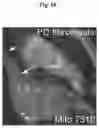 Fig. 19 - METHODS AND COMPOSITIONS FOR MITOCHONDRIAL REPLACEMENT THERAPY
